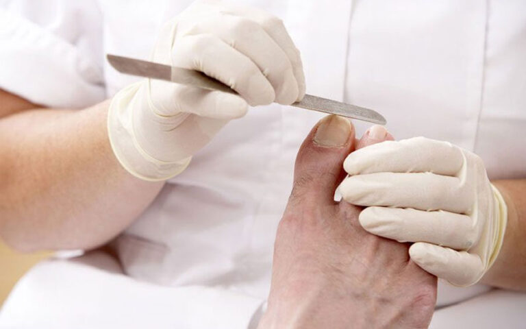Medicinska pedikura Junaki